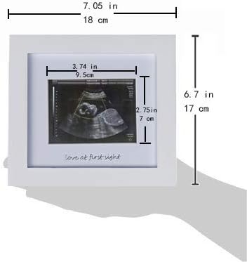 Amazon.com : IHEIPYE Baby Sonogram Photo Frame - 1st Ultrasound Picture Frame - Idea Gift for Expect
